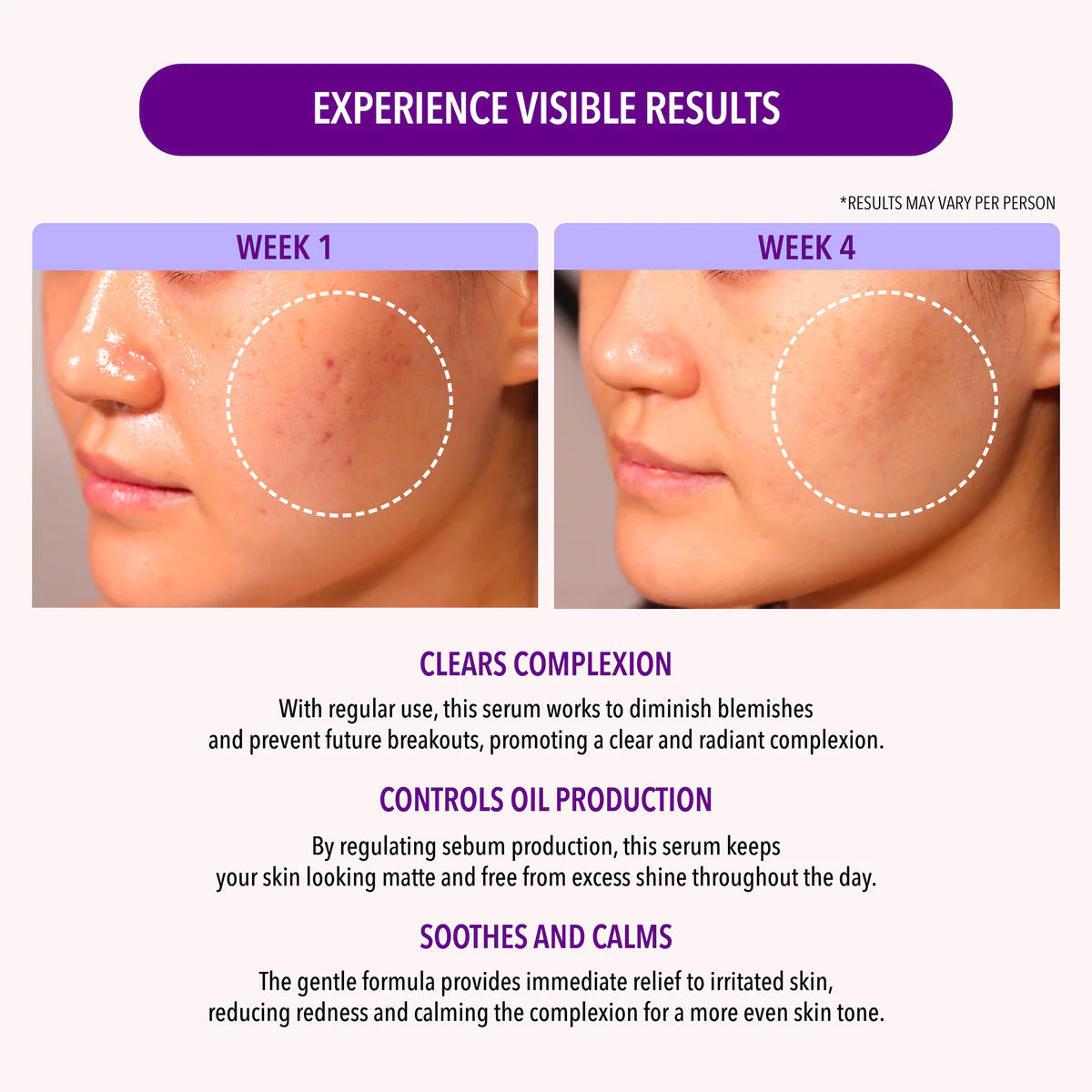 Serum 10% Niacinamide & 1.9% Salicylic Acid - Suero Oil Control