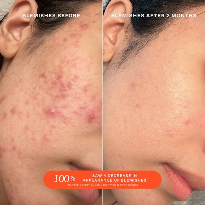 Sephora Favorites Holiday Cozy & Clean Makeup Value Set (2025)